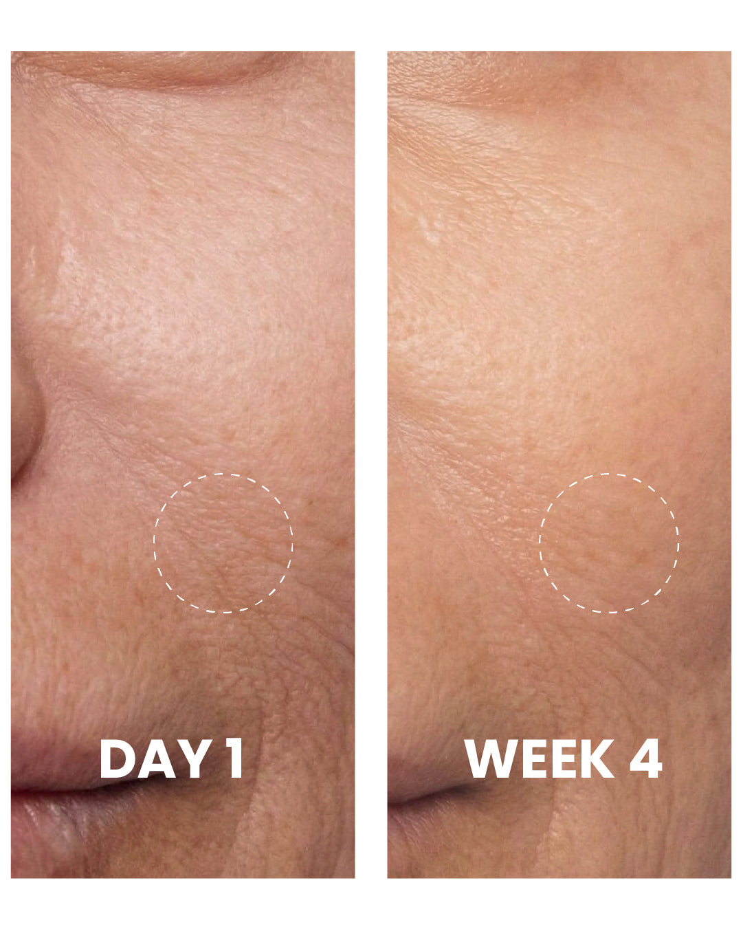 acetyl glutathione benefits Benefits of Glutathione - Helps Detox Your Liver And Muc acetyl glutathione benefits Benefits of Glutathione - Helps Detox Your Liver And Muc